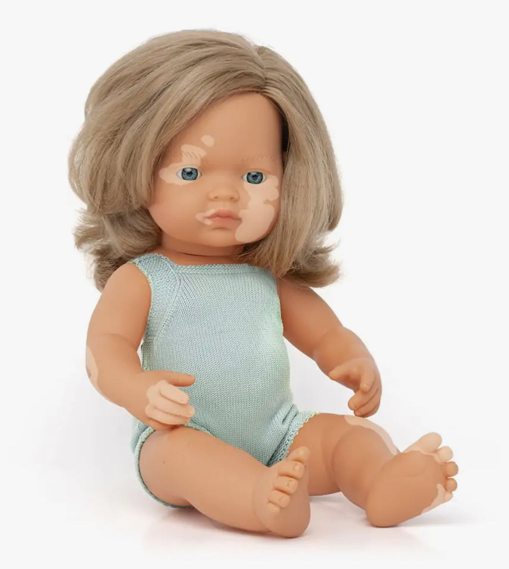 Muñeca diversidad (G) con ropa - Vitiligo (Niña)